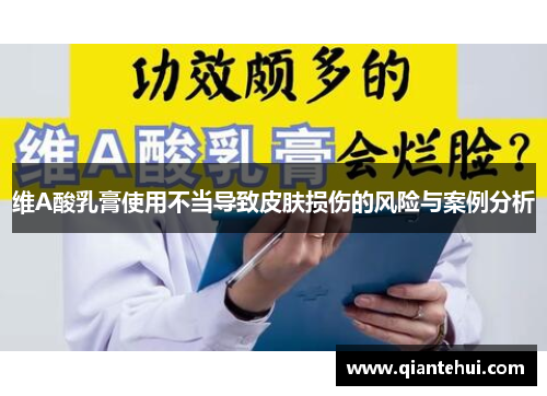 维A酸乳膏使用不当导致皮肤损伤的风险与案例分析